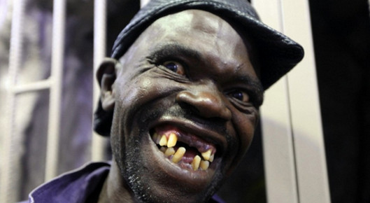 Personaggio Esci Ricevere Uomo Piu Brutto Al Mondo Picnic Nipote Sforzo